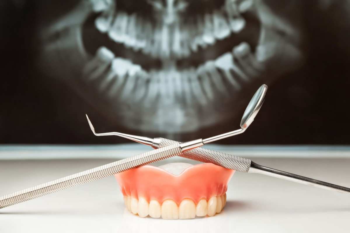 Открытка рентген челюсти  с днем стоматолога   С днем стоматолога 